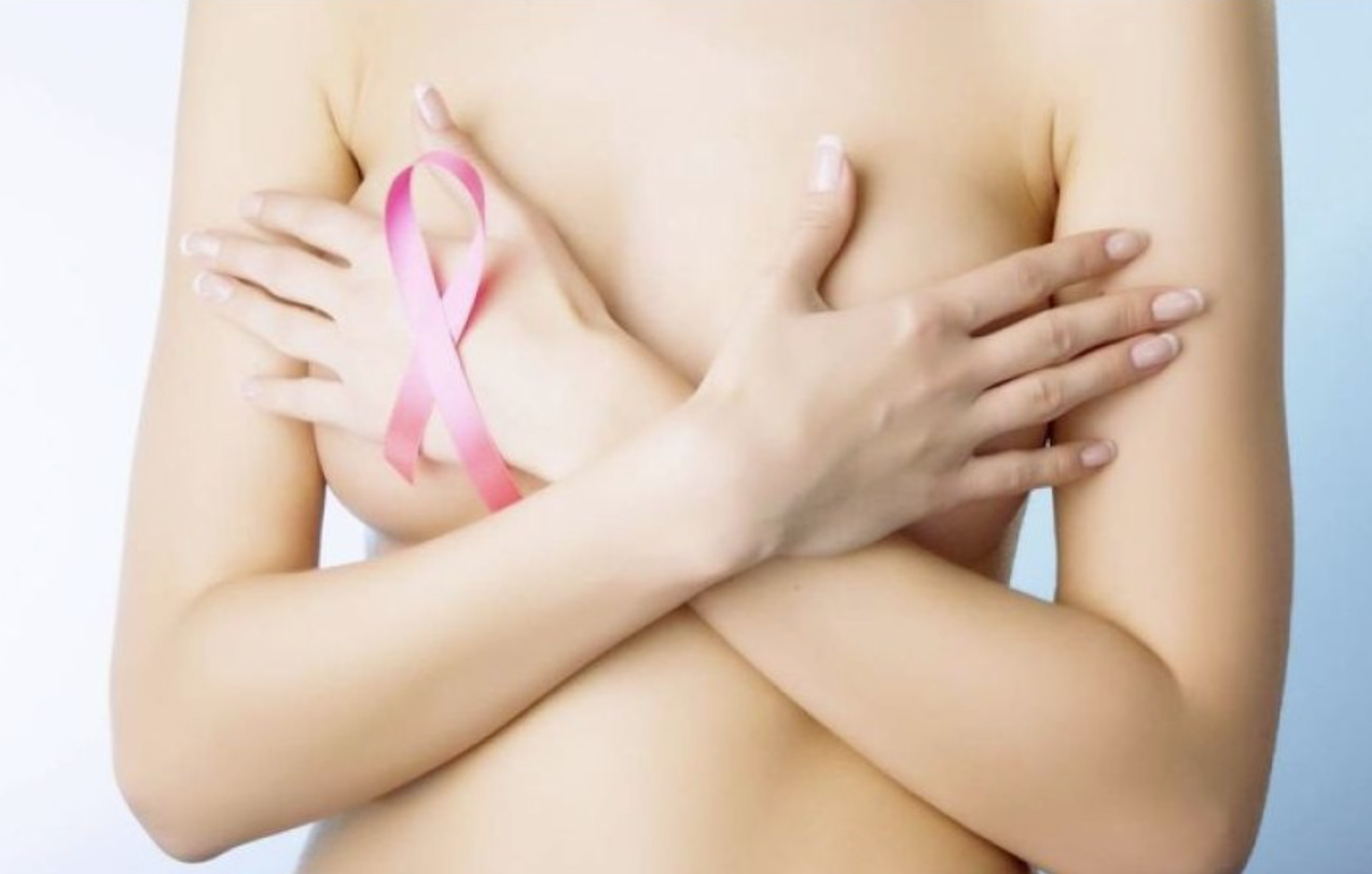 Cáncer de mama y sexualidad femenina 9 Cáncer de mama y sexualidad femenina